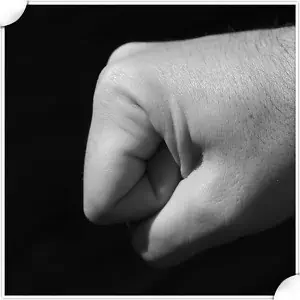 West Palm Beach Assault and Battery Attorney